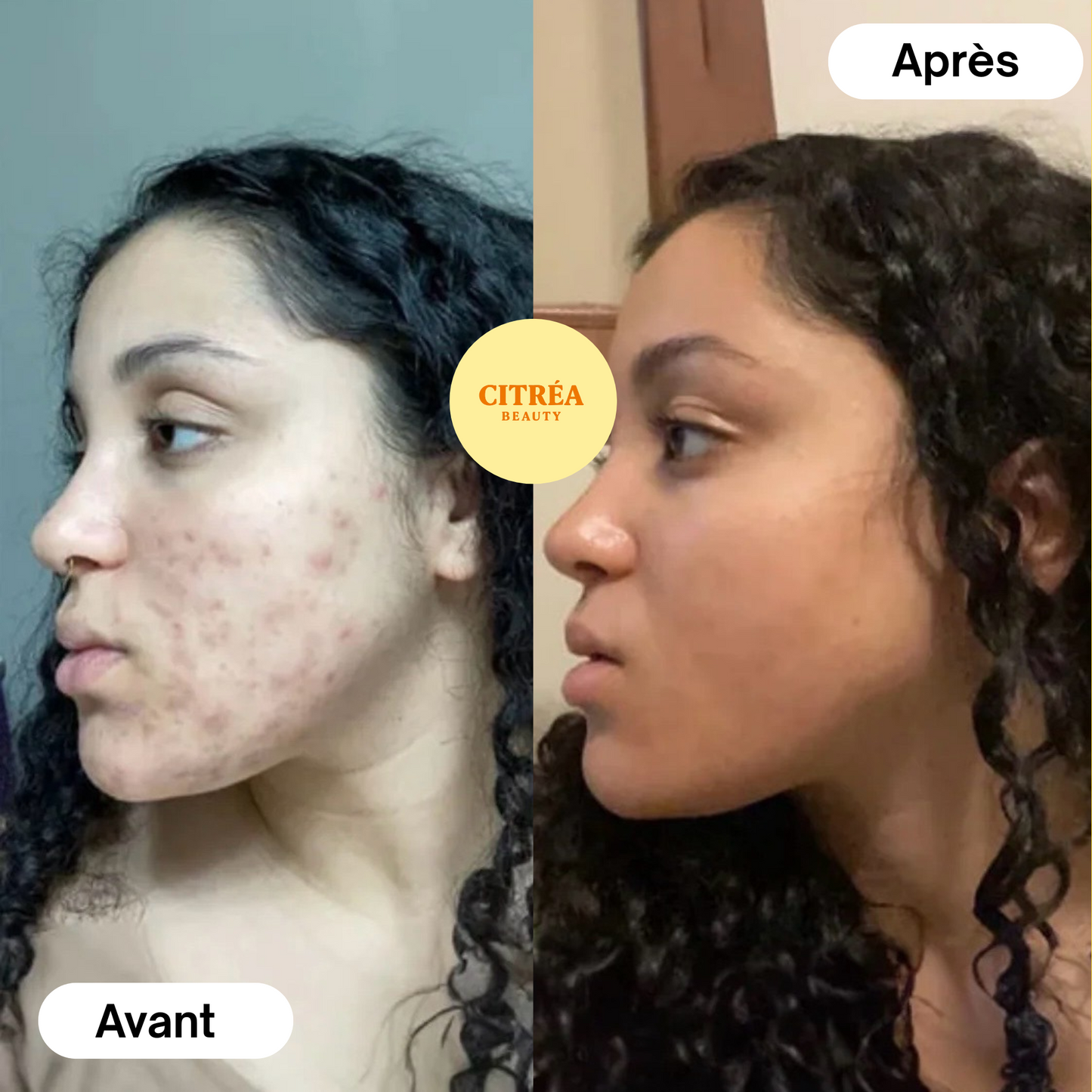 Kit Nettoyant Exfoliant à l’Acide Kojique