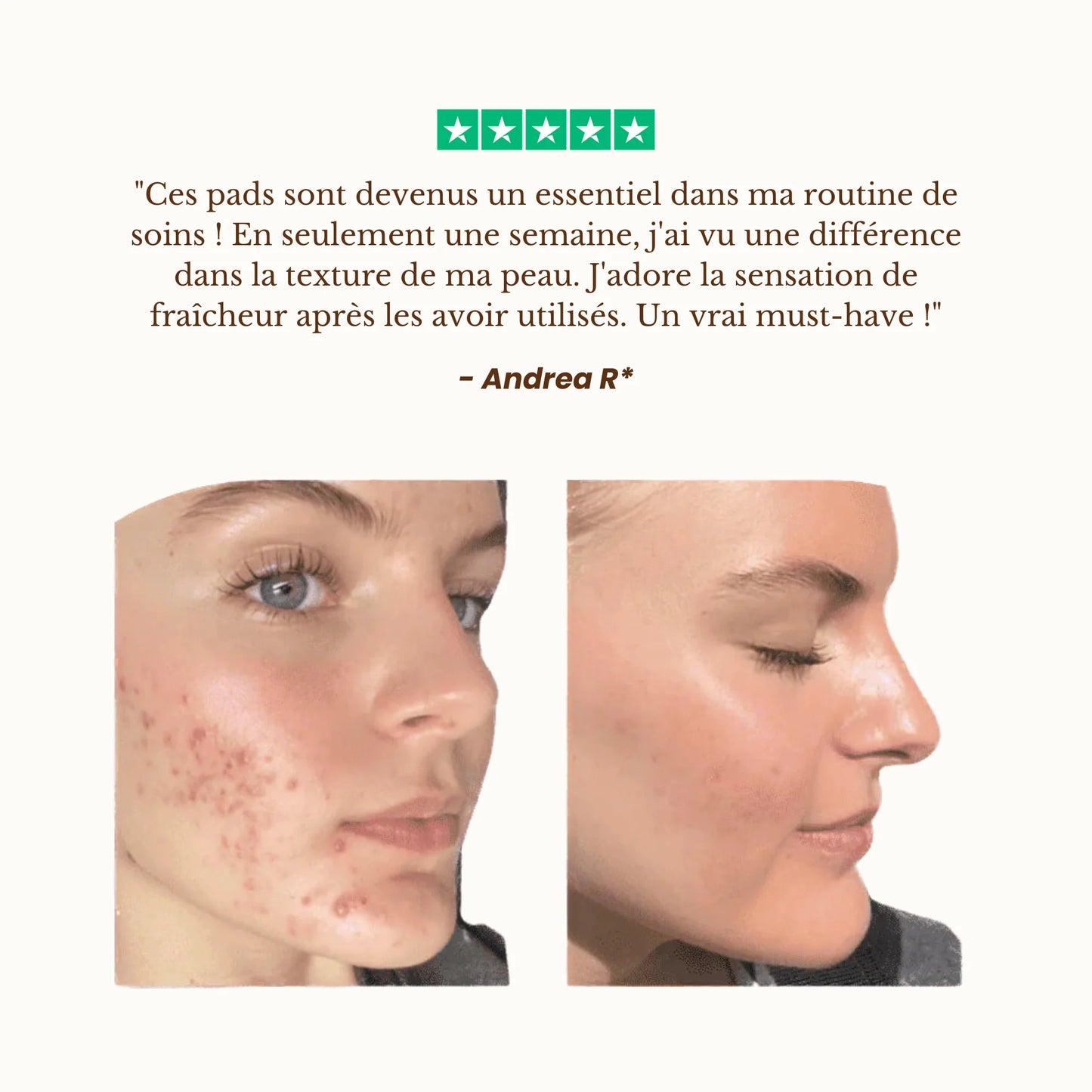 Kit Nettoyant Exfoliant à l’Acide Kojique