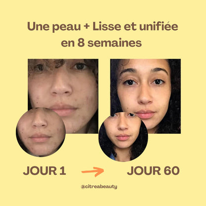 Kit Nettoyant Exfoliant à l’Acide Kojique