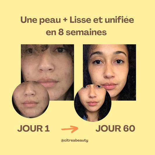 Kit Nettoyant Exfoliant à l’Acide Kojique